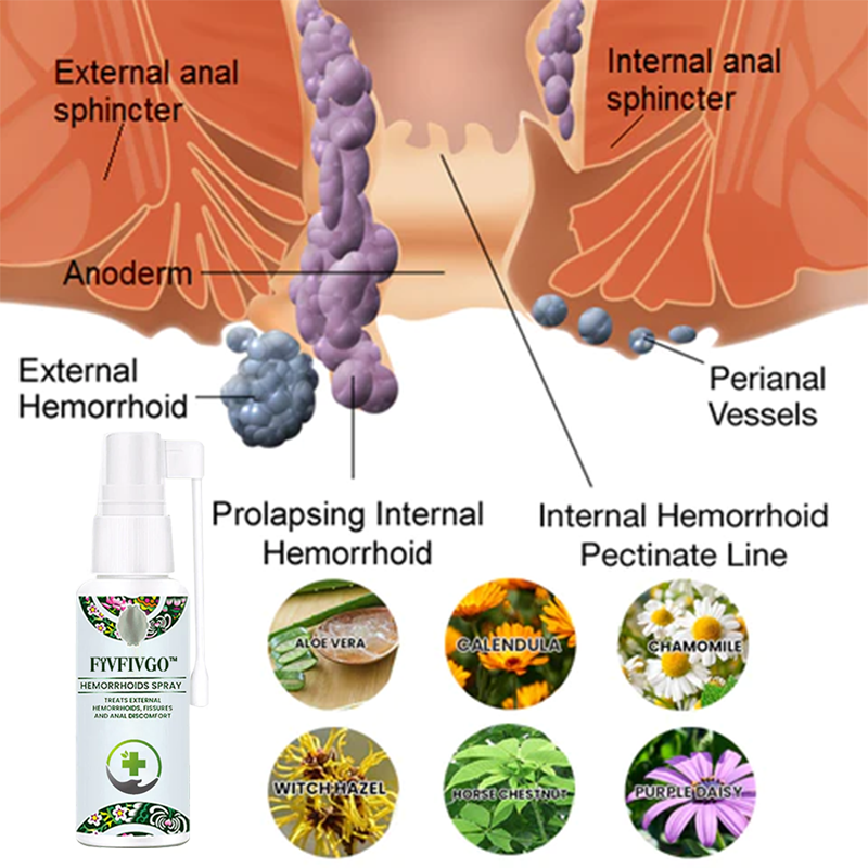 Fivfivgo™ Herbal Hemorrhoid Spray