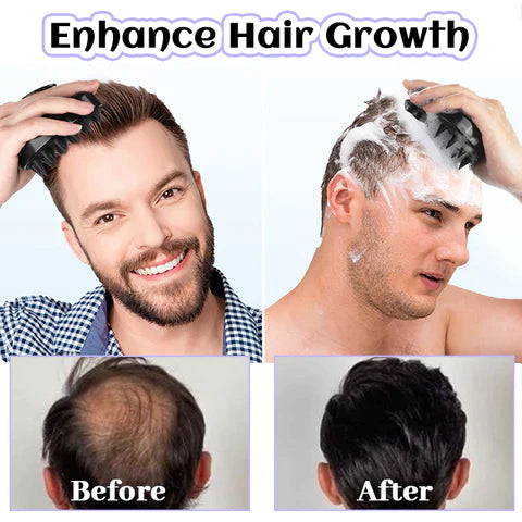 Fivfivgo™ SootheScalp Pro Brosse Masseur