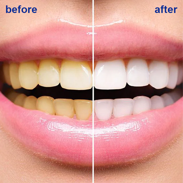 Fivfivgo™ Teeth Whitening Powder