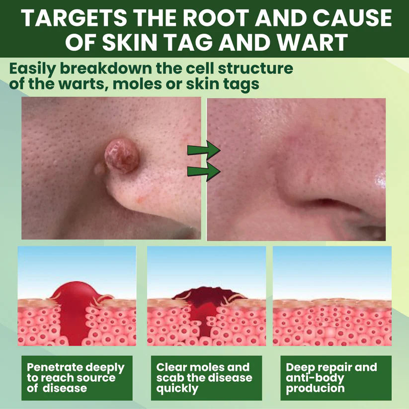 Fivfivgo® Reedle Shot 100 Tag & Spot Target Advanced Serum