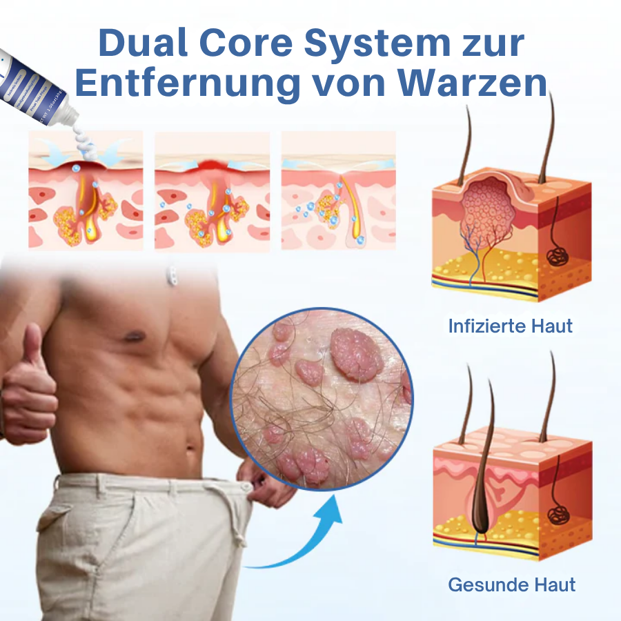 Fivfivgo® GentX Warzenentlastungs Creme