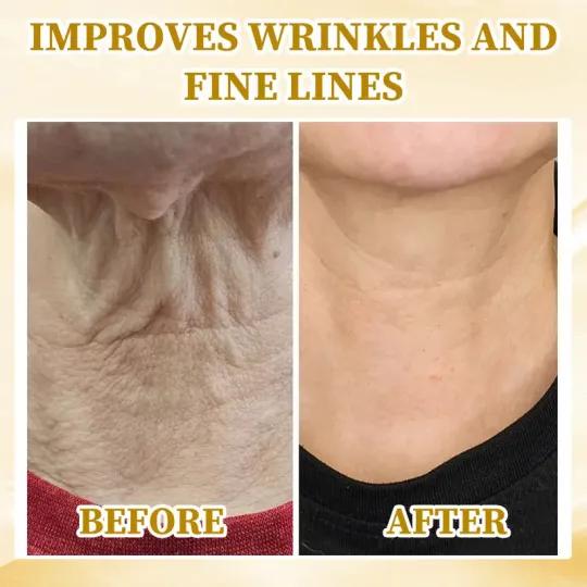 Fivfivgo™ Ultra-Firming & Repairing Multi-Purpose Cream: Reshape skin, activate cells