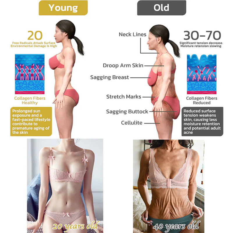 Fivfivgo™ Wrinkle Removel Cream (Address Crepe & Sagging)