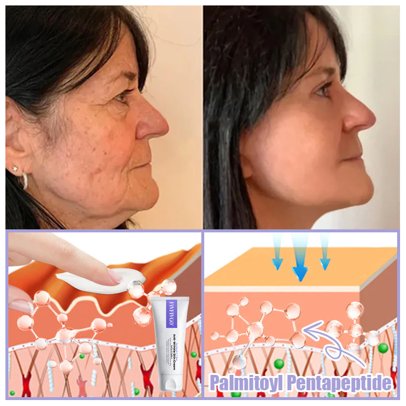 Fivfivgo® Anti-Falten-Hautcreme zum Entfernen von Falten, Straffen der Haut, Aufhellen - Last Day Sale🔥90% OFF
