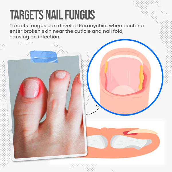 Fivfivgo™ FungusShield Nail Fungus Treatment Cream