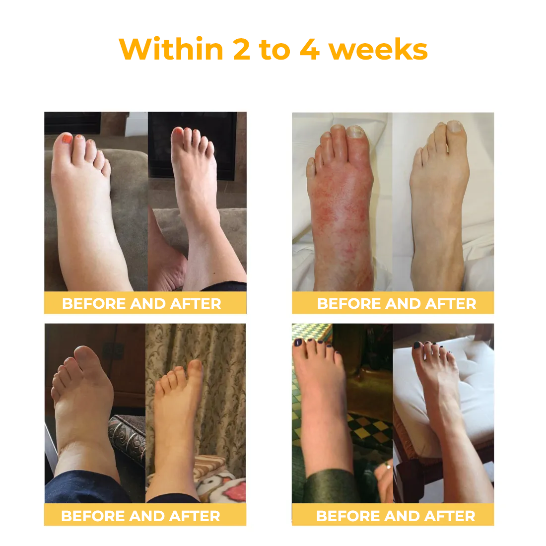 Fivfivgo™ Creme zur Behandlung von rheumatoider Arthritis und Krampfadern