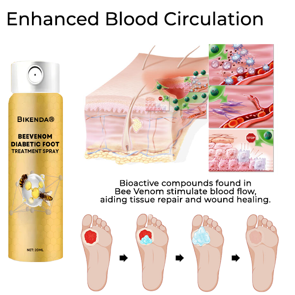 Bikenda® BeeVenom Diabetic Foot Treatment Spray