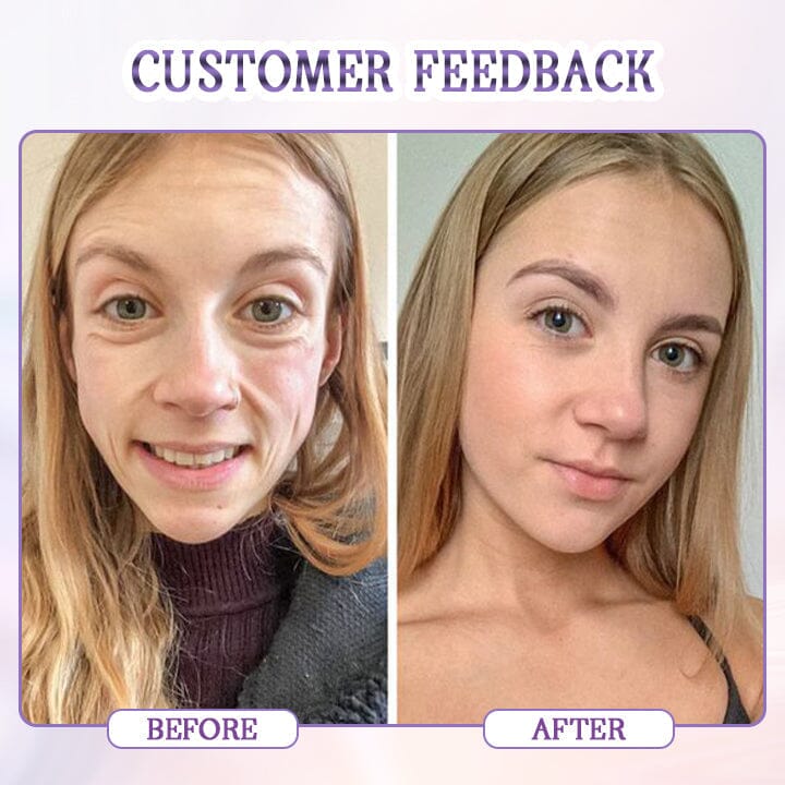 Fivfivgo™ Age-Defying Botulinum Gesichtsserum