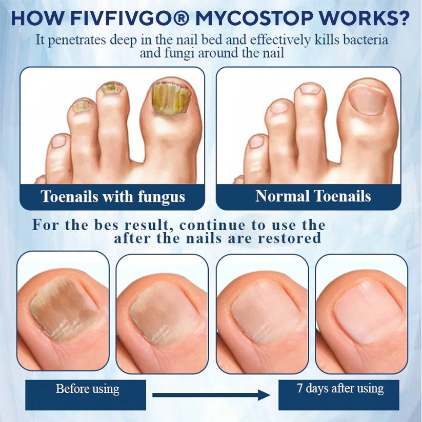 Fivfivgo® MycoStop Nail Recovery Serum Pen