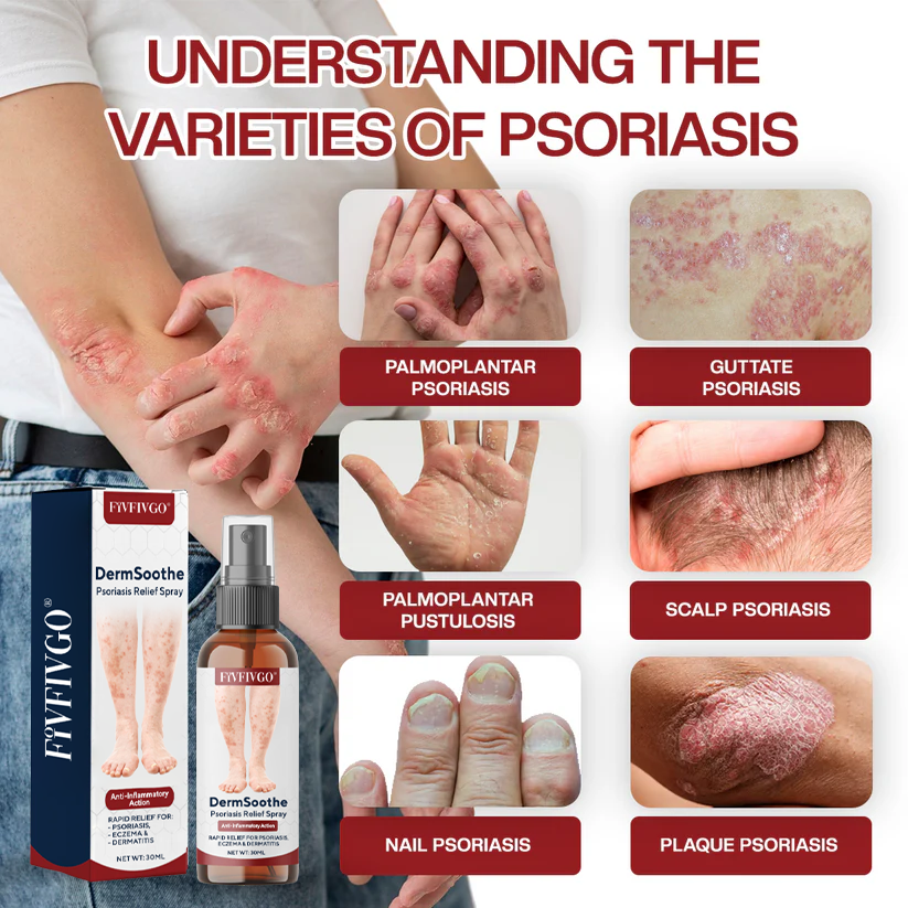 Fivfivgo® DermSoothe Psoriasis Relief Spray