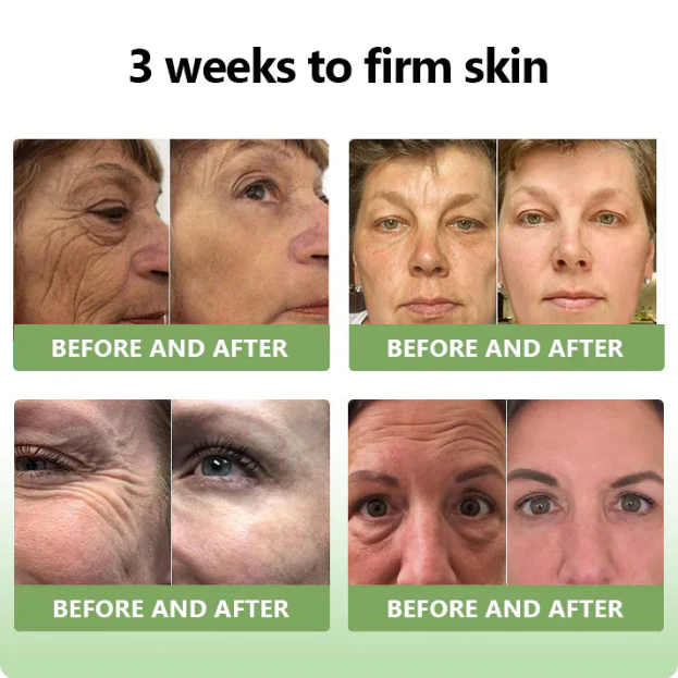 Fivfivgo™ Luxurious Collagen Peptide Firming Cream
