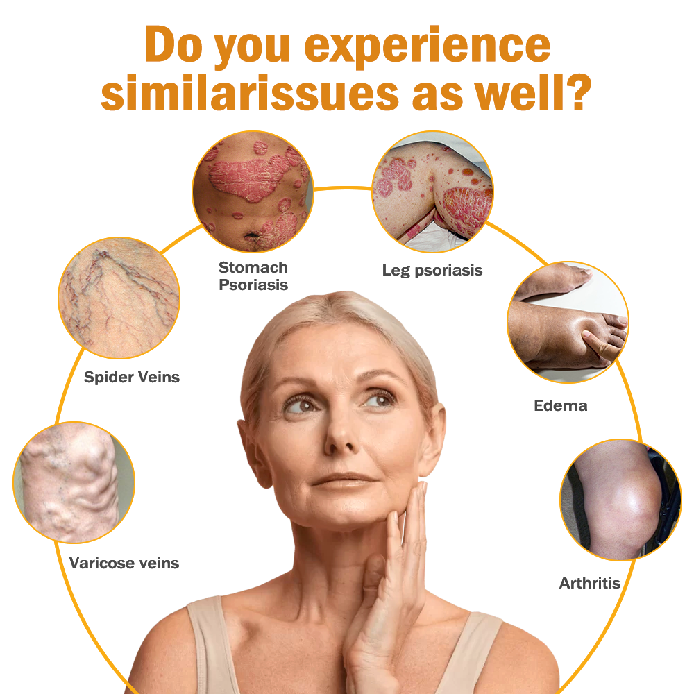 Fivfivgo™ Arthritis und Varikose Behandlung Creme
