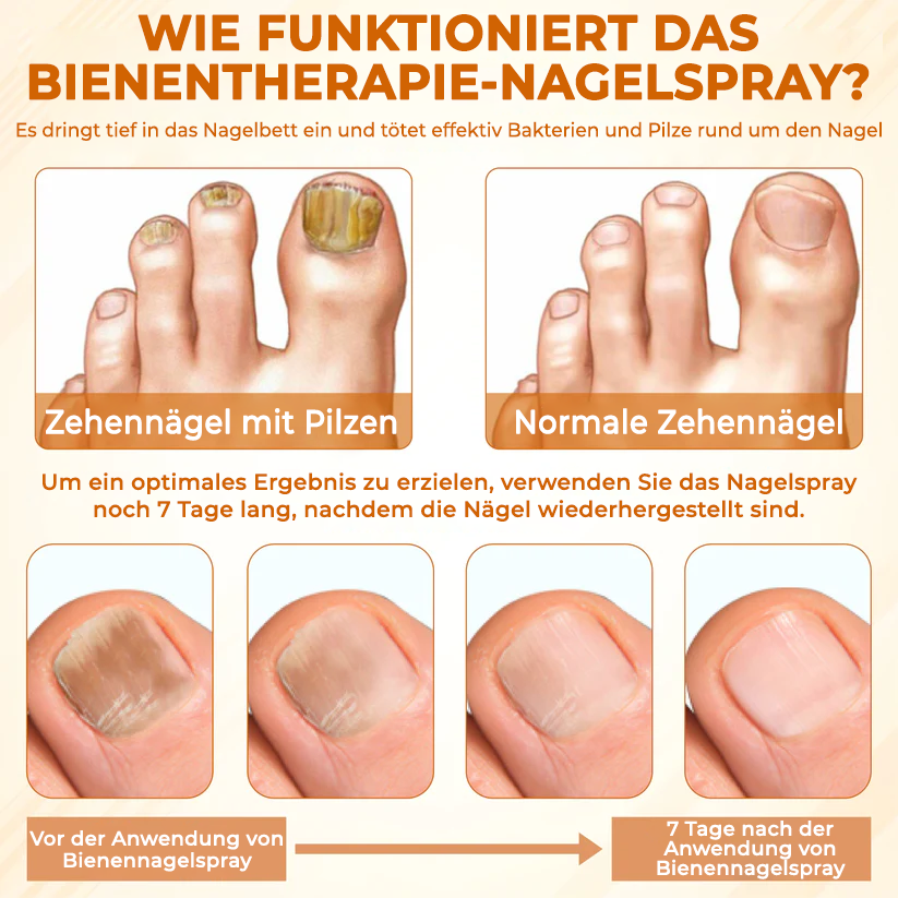 Fivfivgo® Fungiclear Bienen Therapie Nagelspray