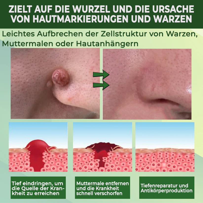 Fivfivgo® Reedle Shot 100 Tag & Spot Zielscheibe Fortgeschrittenes Serum