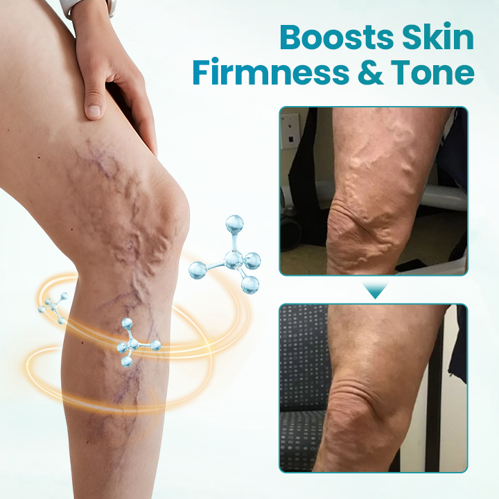 Fivfivgo® VeinEase Soothing Cream