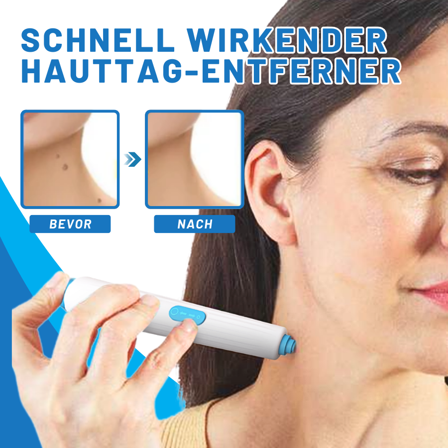 Fivfivgo™ Zu Hause Haut Tag Einfädeln Stift