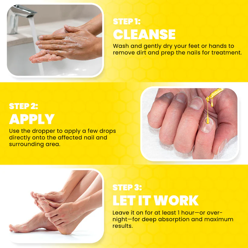 Fivfivgo® ClariNail Bee Venom Fungal Solution Drops