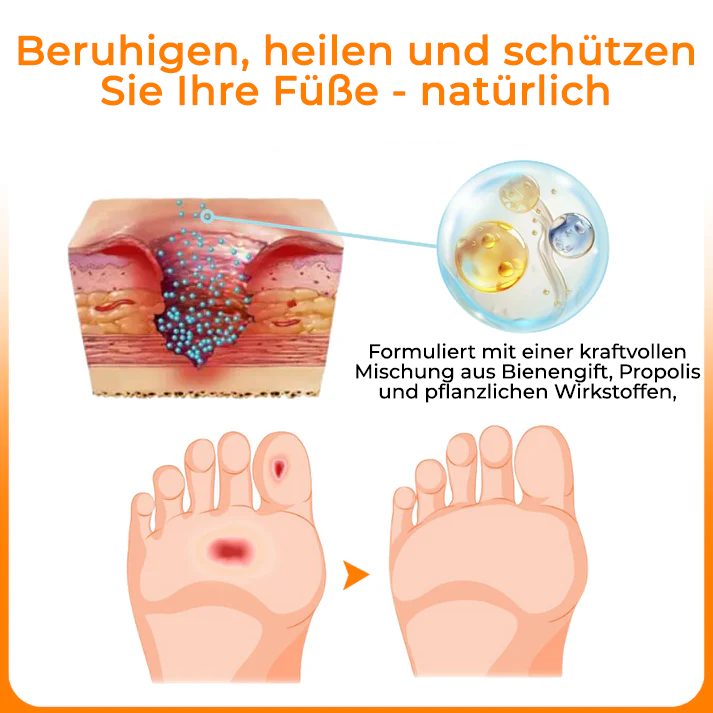 Bikenda® VenHeal Bienengift Diabetiker-Wundspray