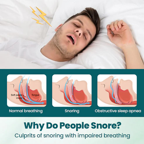 Fivfivgo™ SilentBreathe Anti-Schnarch-Pflaster