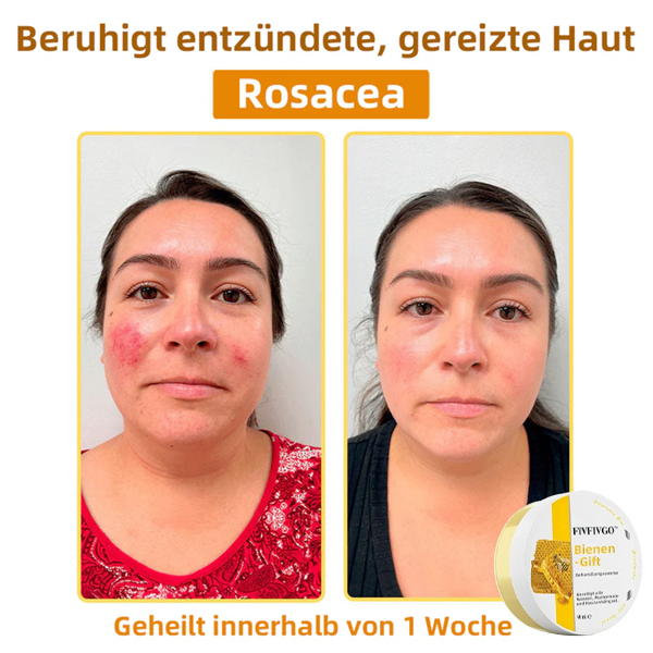 Fivfivgo™ Bienengift-Therapie-Creme
