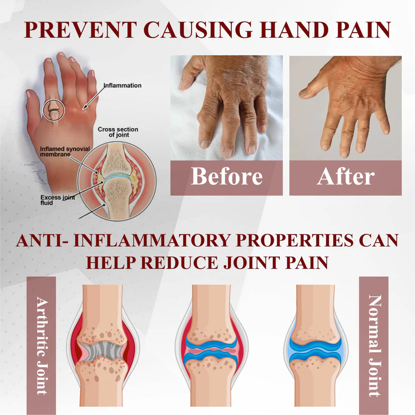 Fivfivgo™ Rosskastanie Arthritis-Massagecreme
