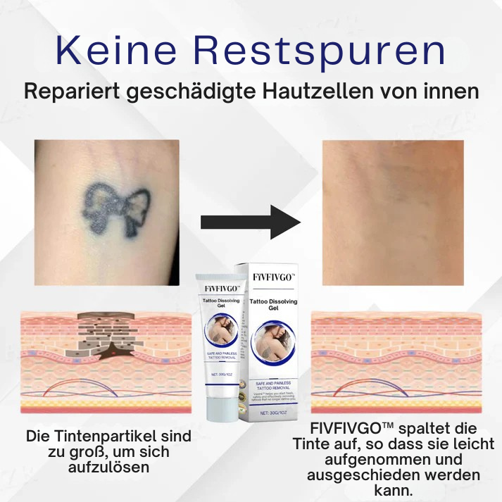 Fivfivgo™ Tattoo-Löschgel