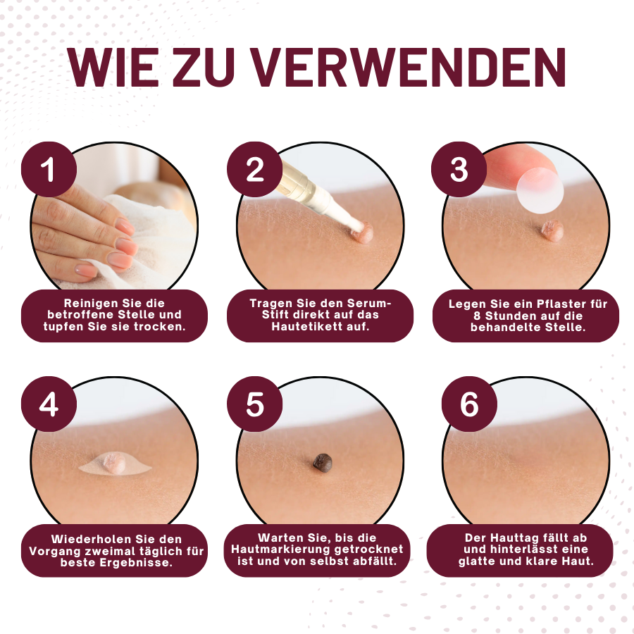 Fivfivgo™ Haut Tag Entfernungsaufkleber