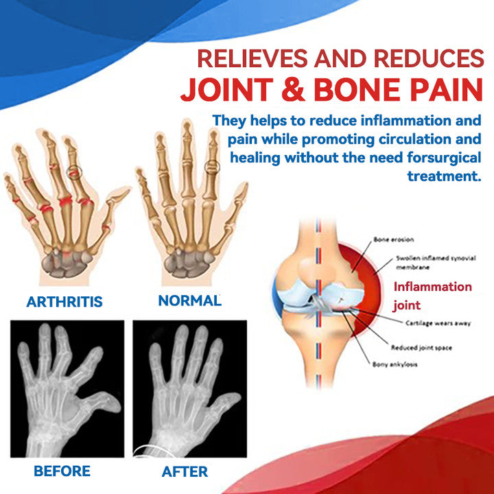 Fivfivgo™ Gel per la terapia delle articolazioni e delle ossa - Recupero completo del corpo