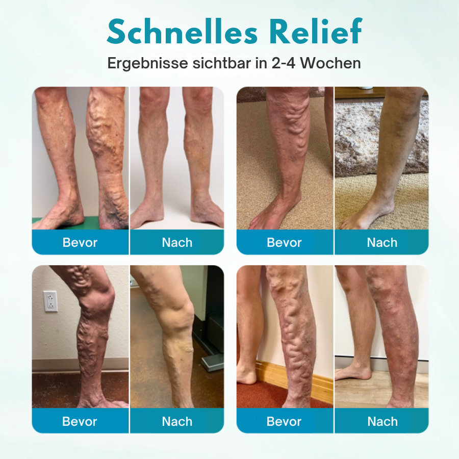 Fivfivgo® VeinEase Beruhigende Creme