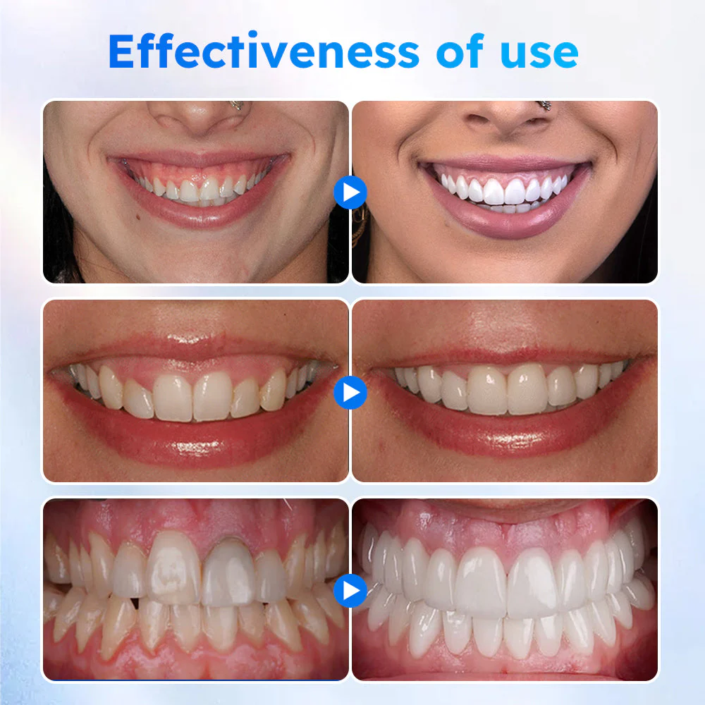 Fivfivgo™ Gel de gomme pour traitement oral