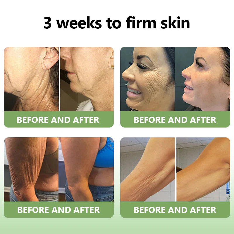 Fivfivgo™ Luxe Collagen Straffende Creme