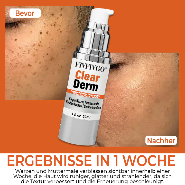Fivfivgo® ClearDerm Fortgeschrittenes Serum gegen Warzen und dunkle Flecken
