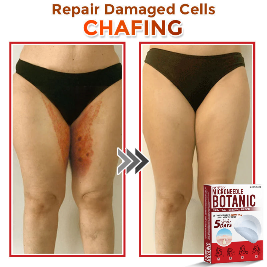 Fivfivgo® MicroNeedle Botanic Skin Tag Removal Patch 🇺🇸 Made in the USA