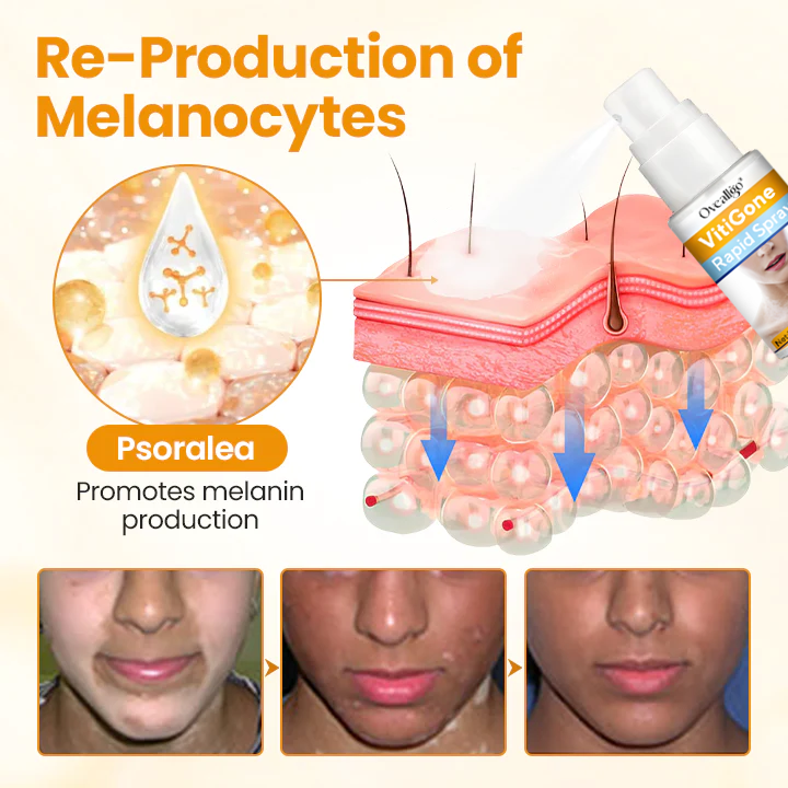 Oveallgo® VitiGone Rapid Spray