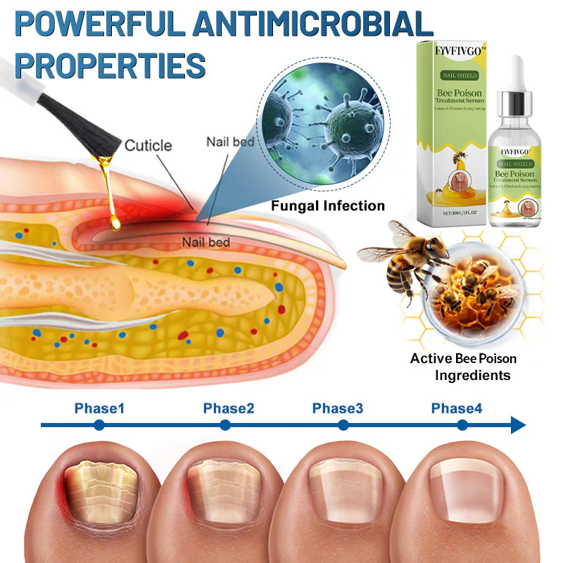 Fivfivgo™ Nagelpilz Bienengift Behandlung Serum