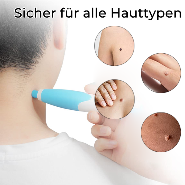 Fivfivgo™ 2-in1 Werkzeug zur schmerzlosen Entfernung von Hautmarkierungen