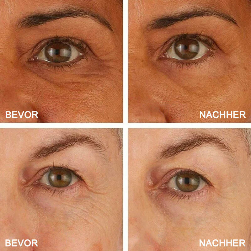 Fivfivgo™ Creme zur sofortigen Straffung der Augenfalten