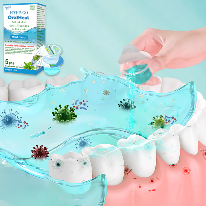 Fivfivgo™ OralHeal Mundwasser – entfernt Zahnstein, hellt die Zähne auf, beugt Mundgeschwüren und Karies vor und behandelt sie, beseitigt Mundgeruch