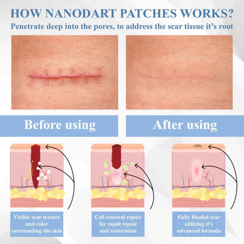 Fivfivgo® ScarRepair EGF Nanodart Patches