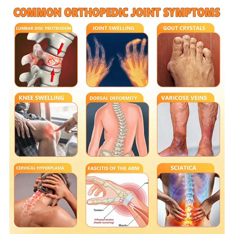 NovaRX®  Bee Venom Pain-Relief Joint Soothing Spray