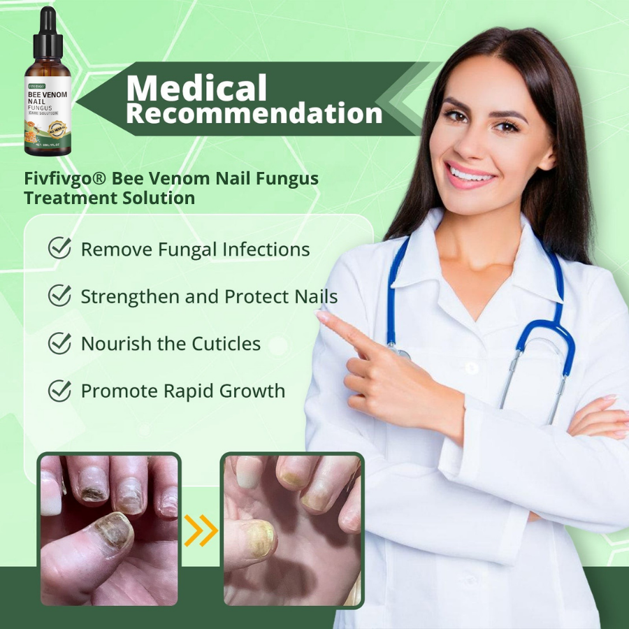 Fivfivgo® Bee Venom Nail Fungus Treatment Solution: Natural Formula for Toenail & Fingernail Health