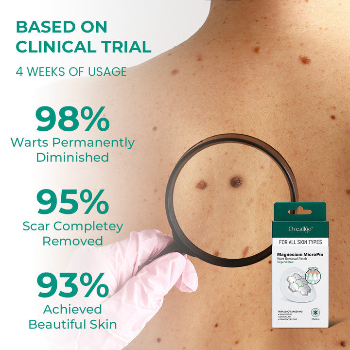✅Official Store: Oveallgo® Magnesium MicroPin Target & Clear Wart Removal Patch