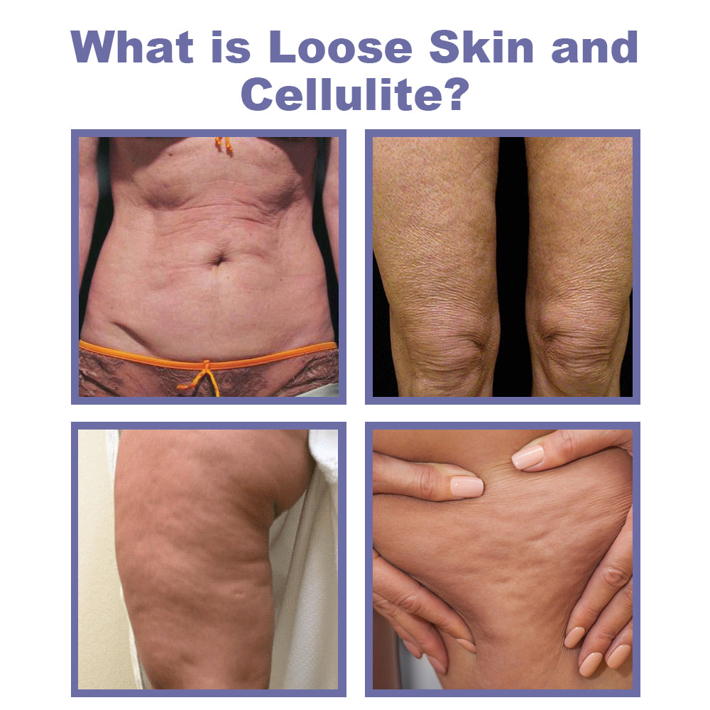 Oveallgo™ Slimming Invisible Leg Lift