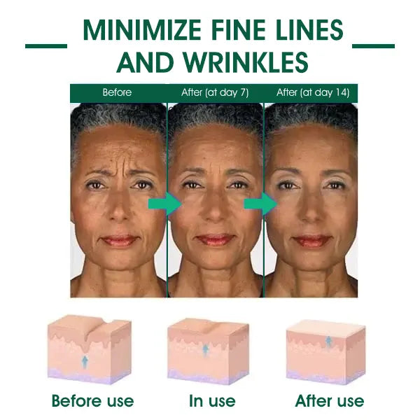 Fivfivgo™ Botox Facial Serum