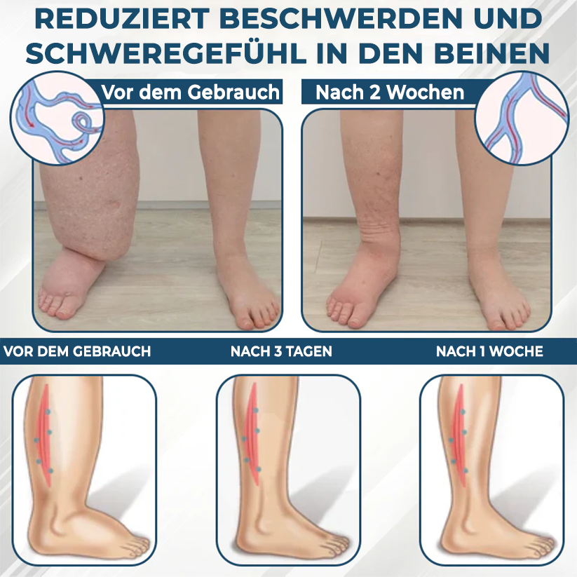 Fivfivgo® VenoHerb Schwarzkümmel-Ödemlöser-Balsam