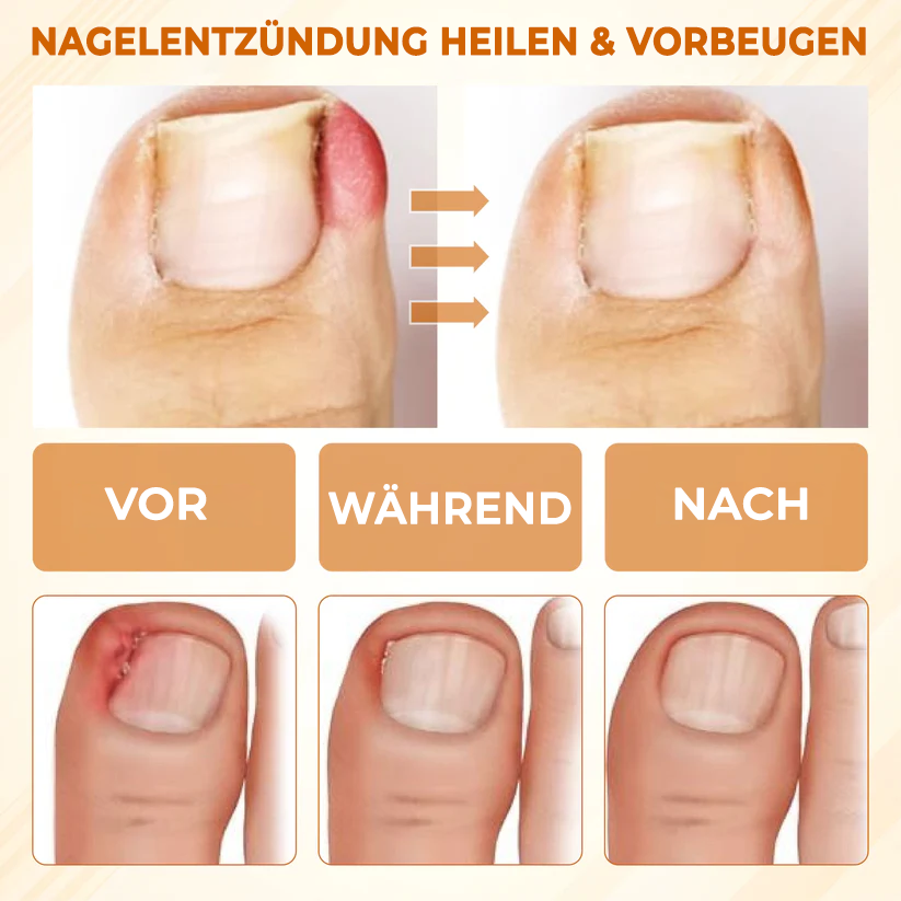 Fivfivgo® Fungiclear Bienen Therapie Nagelspray