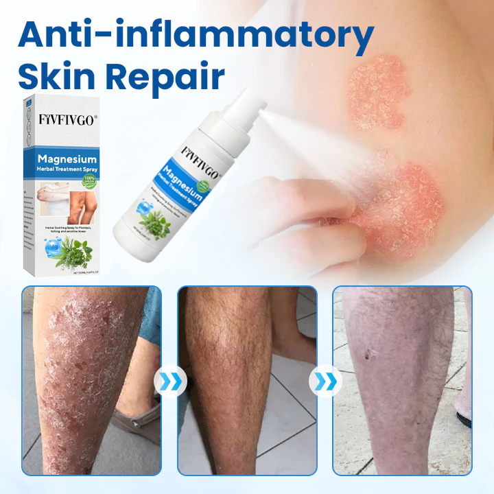 Fivfivgo® Magnesium Herbal Treatment Spray