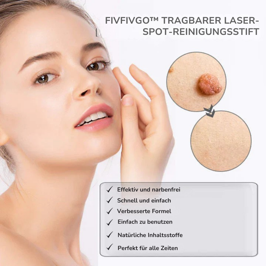Fivfivgo™ Tragbarer Laser-Spot-Reinigungsstift