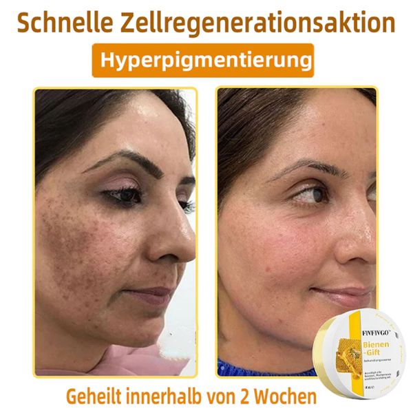 Fivfivgo™ Bienengift-Therapie-Creme