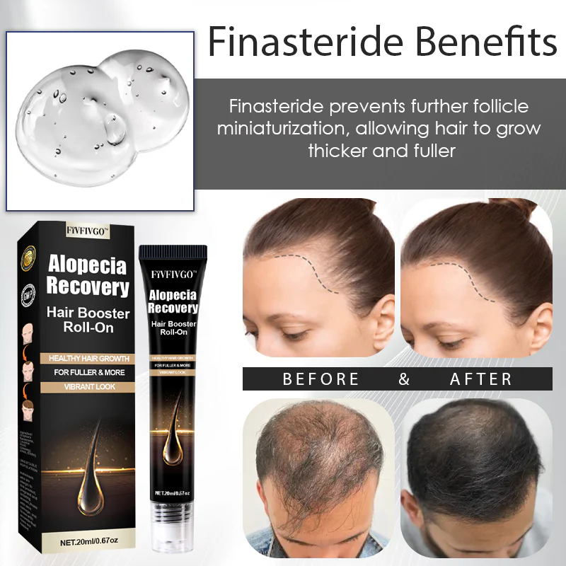 Fivfivgo™ Alopecia Recovery Hair Booster Roll-On